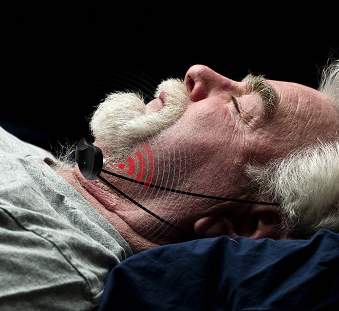 Intelligent Anti-snoring Device Anti-snoring Magic Health Device