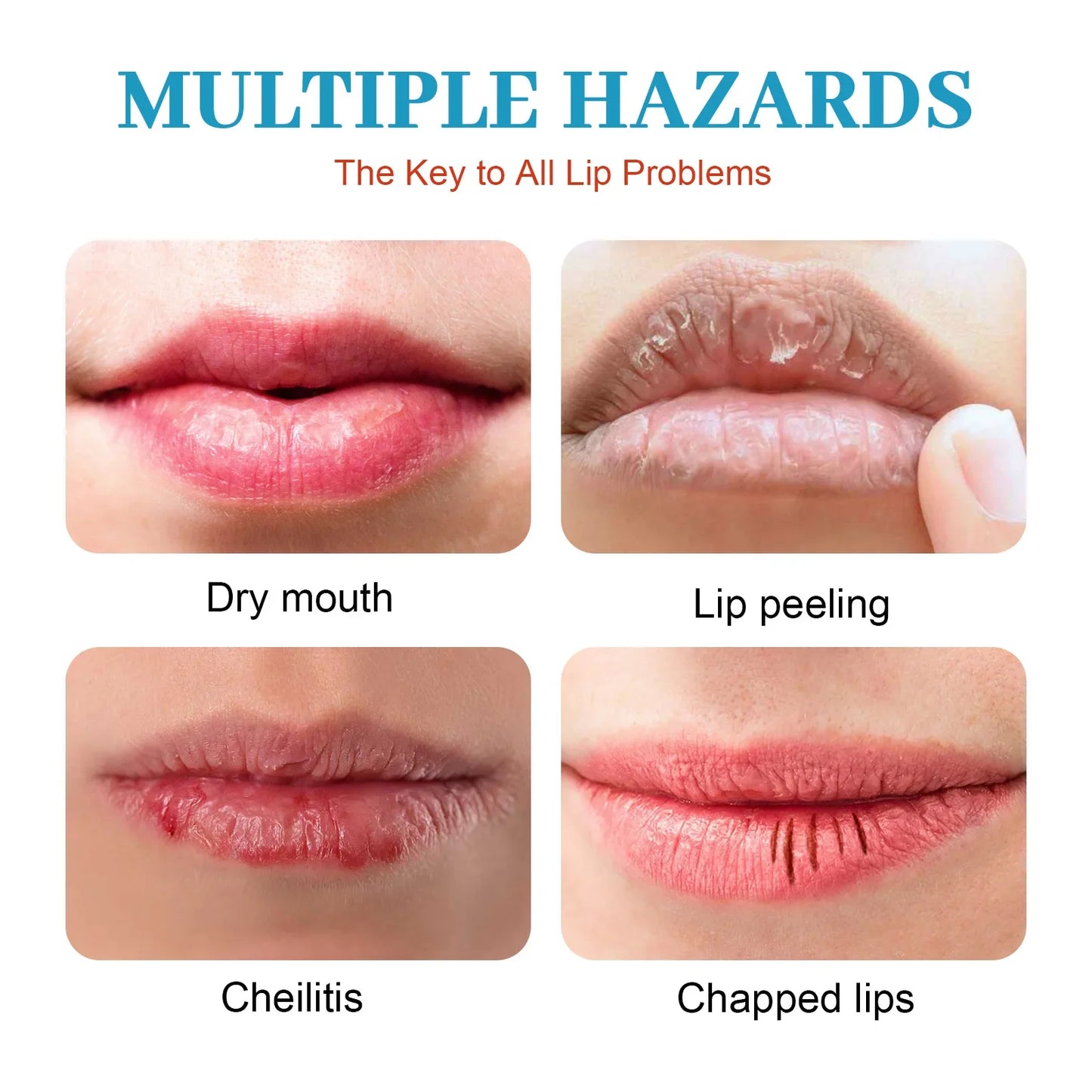 Lip Pattern Care Cream Water Moisturizer Translucent Lip Oil Lip Repair Cream Moisturizing Hydrating Anti Drying Lightening