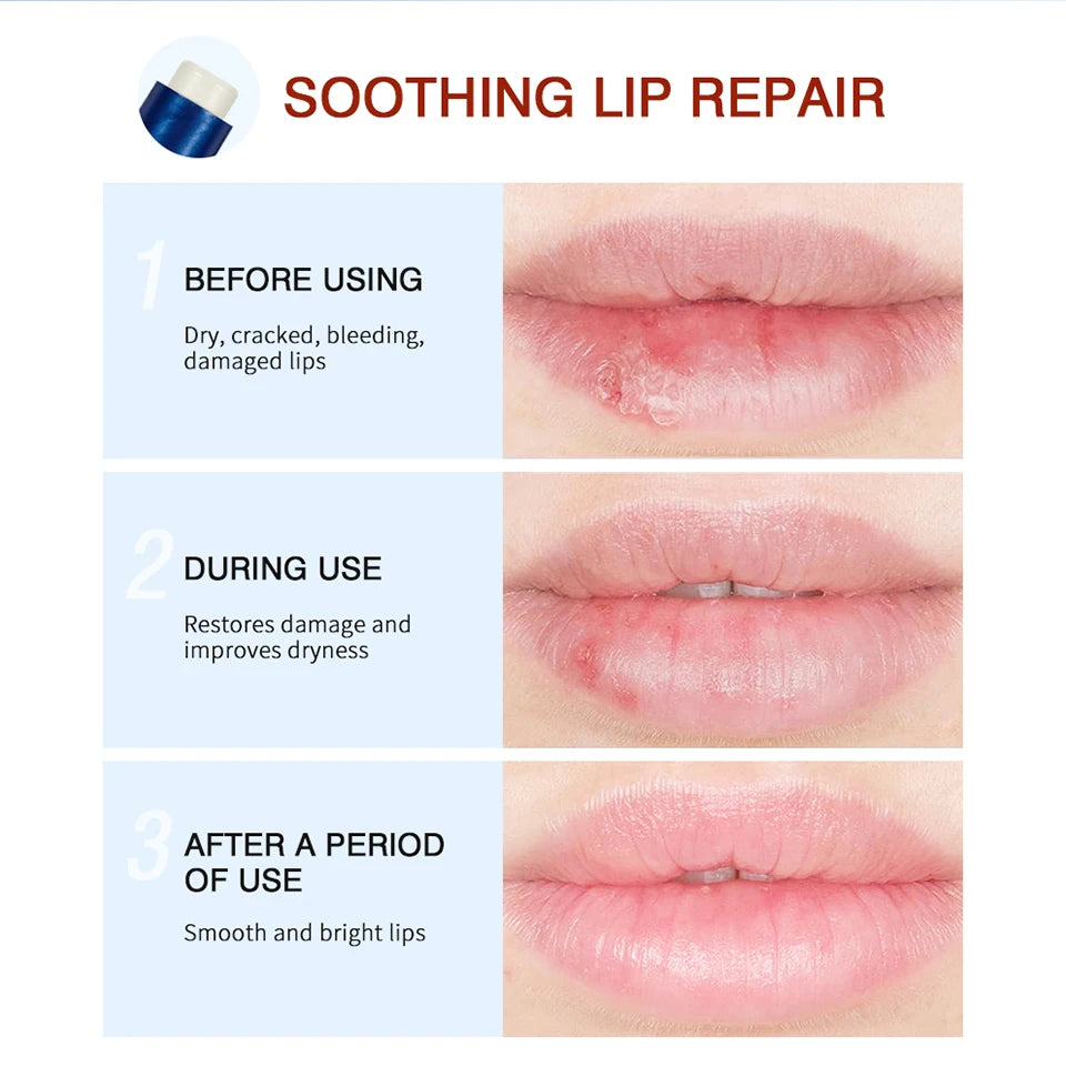 Lip Aquaphor Moisturize Repair Stick Hydrating Lip Protection Moisturizing Anti-Drying Lip Balm Lip Care Product Lip Balm Men