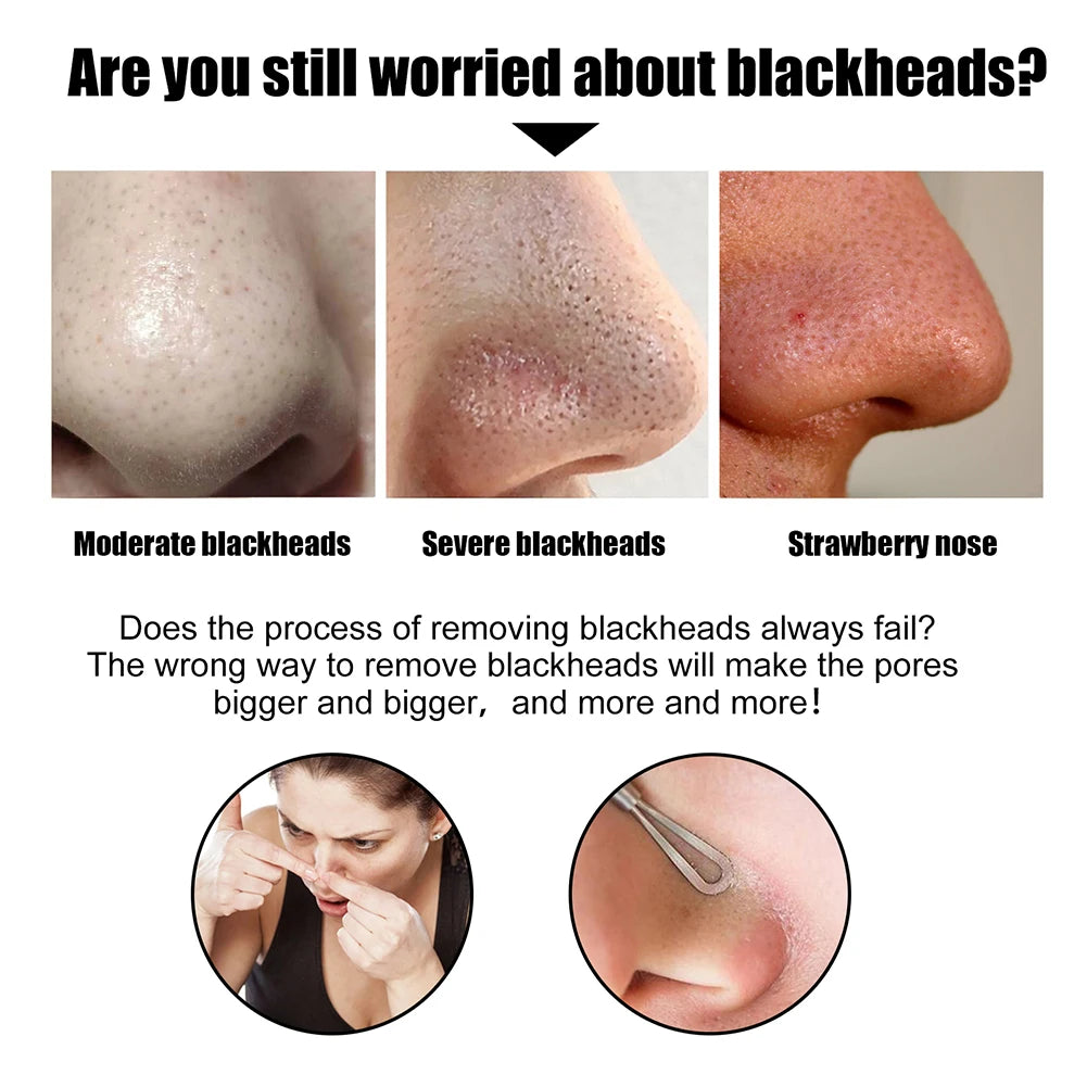 Peel Off Blackheads Remove Plaster Nose Strips Pull Black Mask for Women Beauty