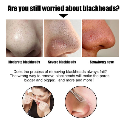 Peel Off Blackheads Remove Plaster Nose Strips Pull Black Mask for Women Beauty