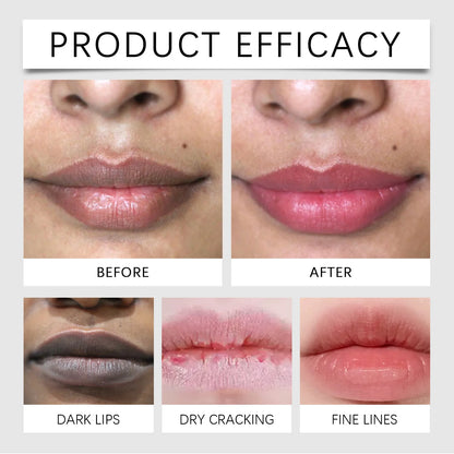 Lip Brightening Balm Moisturizing Care Long Lasting Hydration Smooth Lip Non Drying Non Irritating Safe for Dry Chapped Lip 10ml