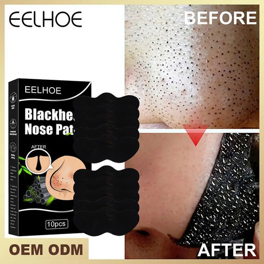 Peel Off Blackheads Remove Plaster Nose Strips Pull Black Mask for Women Beauty