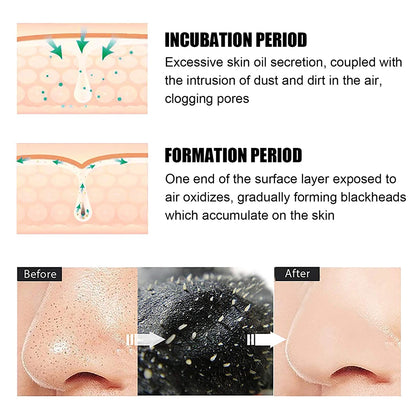 Peel Off Blackheads Remove Plaster Nose Strips Pull Black Mask for Women Beauty