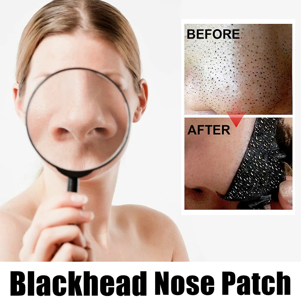 Peel Off Blackheads Remove Plaster Nose Strips Pull Black Mask for Women Beauty